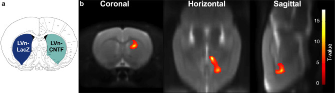 Reactive astrocytes mediate TSPO overexpression in response to sustained CNTF exposure in the rat striatum.