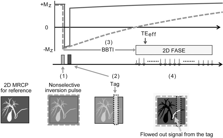 Using Spin-labeled MR Imaging to Depict Slow Pancreatic Juice Flow.