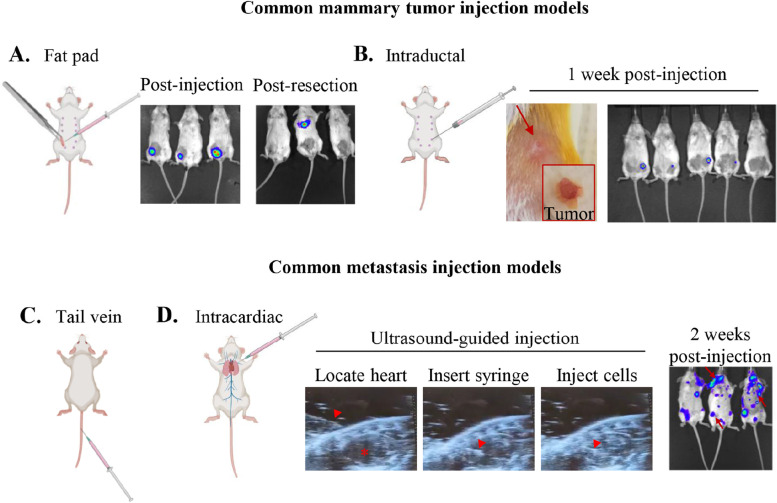 Gestational Breast Cancer - a Review of Outcomes, Pathophysiology, and Model Systems.