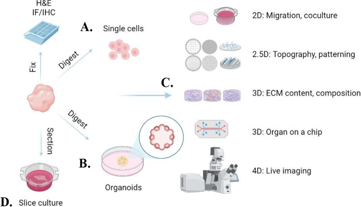 Gestational Breast Cancer - a Review of Outcomes, Pathophysiology, and Model Systems.