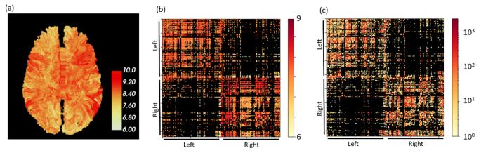 A Method for In-Vivo Mapping of Axonal Diameter Distributions in the Human Brain Using Diffusion-Based Axonal Spectrum Imaging (AxSI).