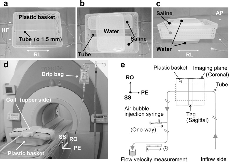 Using Spin-labeled MR Imaging to Depict Slow Pancreatic Juice Flow.