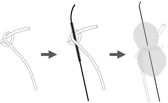 Untangling a Knotted Angiographic Catheter Using a Balloon Catheter: A Case Report.