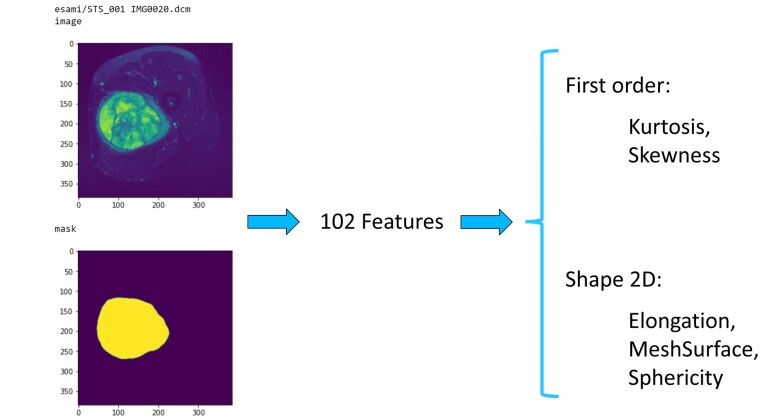 Predicting risk of metastases and recurrence in soft-tissue sarcomas via Radiomics and Formal Methods.