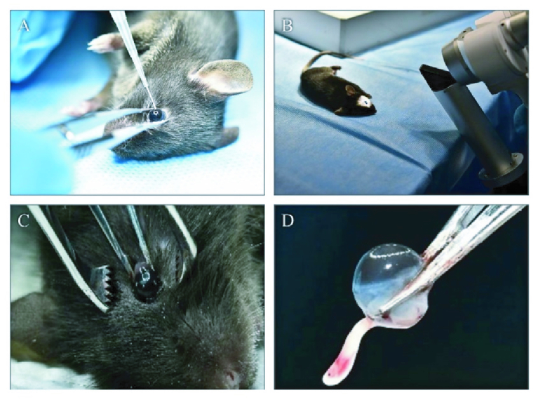 A Novel and Low-cost Approach for Intravitreal Injection in an Experimental Model of Endophthalmitis.