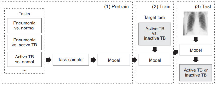 Chest Radiography of Tuberculosis: Determination of Activity Using Deep Learning Algorithm.