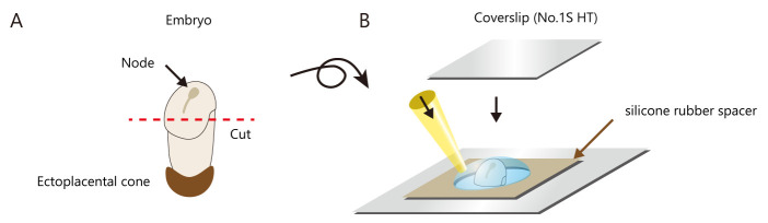 Biophysical Analysis of Mechanical Signals in Immotile Cilia of Mouse Embryonic Nodes Using Advanced Microscopic Techniques.