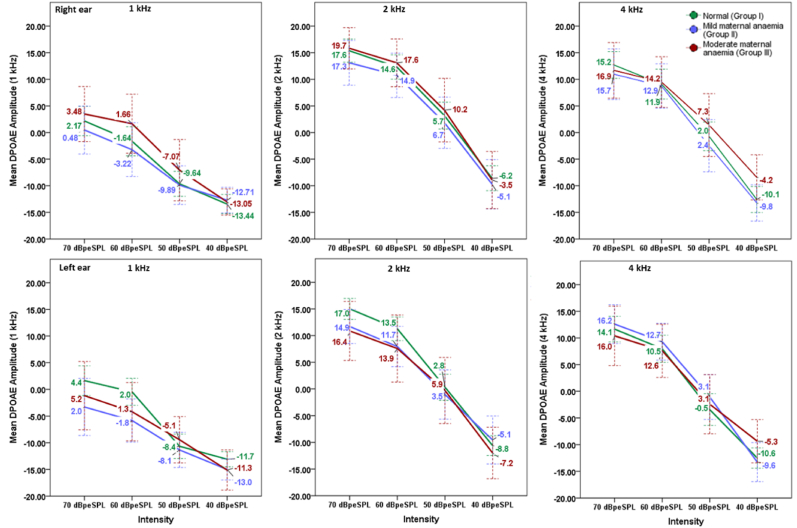 Distortion product otoacoustic emissions in newborn babies with and without late-term maternal iron deficiency anaemia