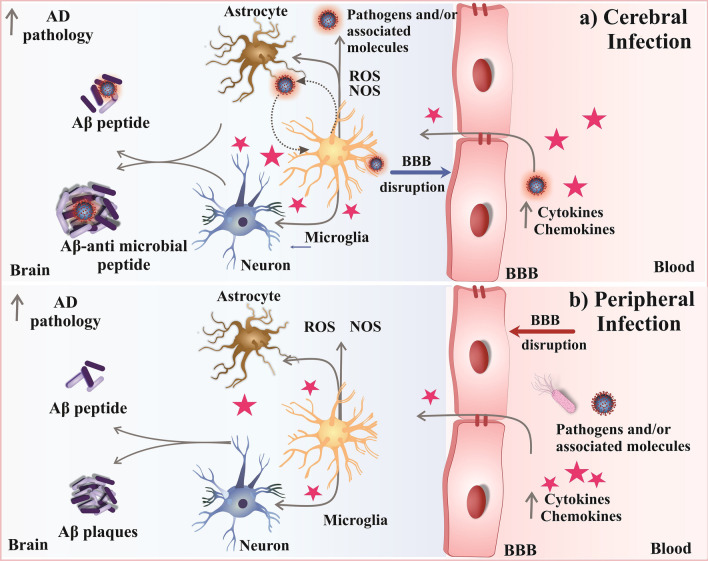 Clinical evidence of human pathogens implicated in Alzheimer's disease pathology and the therapeutic efficacy of antimicrobials: an overview.