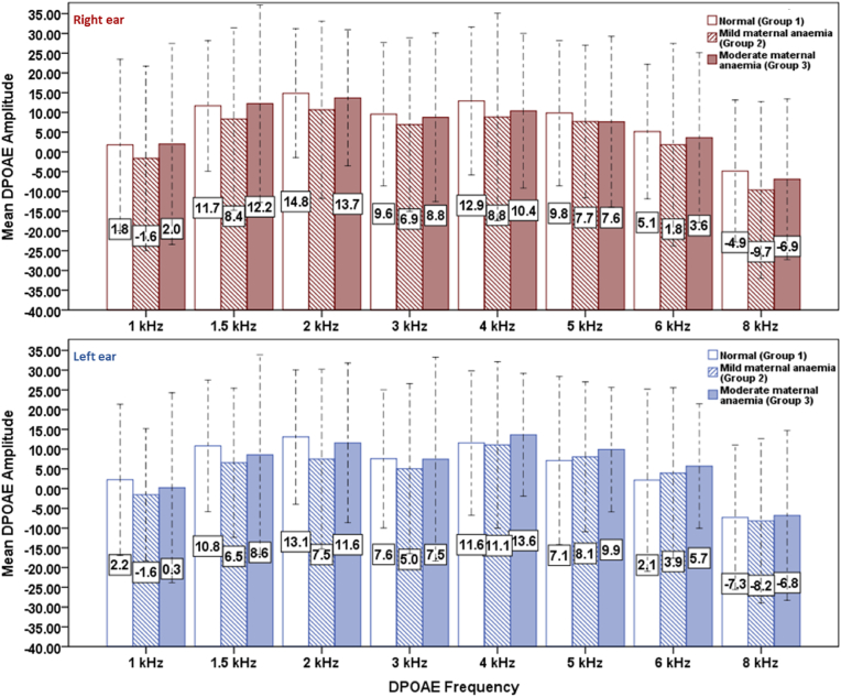 Distortion product otoacoustic emissions in newborn babies with and without late-term maternal iron deficiency anaemia