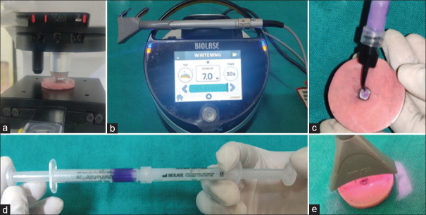 Effect of remineralizing agent on laser and nonlaser bleached enamel surfaces subjected to erosion: An <i>in vitro</i> study.