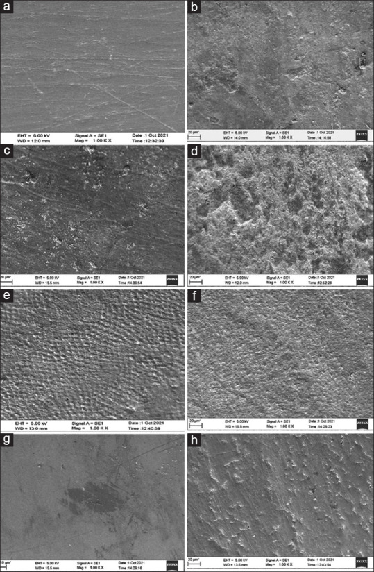 Effect of bleaching on color and surface topography of teeth with enamel caries treated with resin infiltration (ICON<sup>®</sup>) and remineralization (casein phosphopeptide-amorphous calcium phosphate).