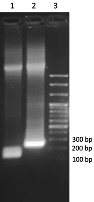 Expression, Purification and Characterization of Functional Teduglutide Using GST Fusion System in Prokaryotic Cells.