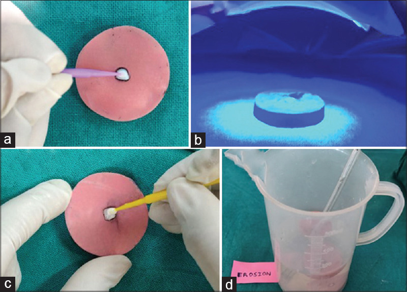 Effect of remineralizing agent on laser and nonlaser bleached enamel surfaces subjected to erosion: An <i>in vitro</i> study.