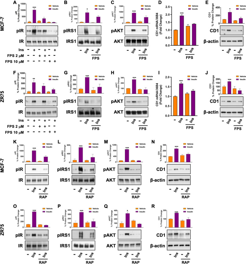 RAGE inhibition blunts insulin-induced oncogenic signals in breast cancer.