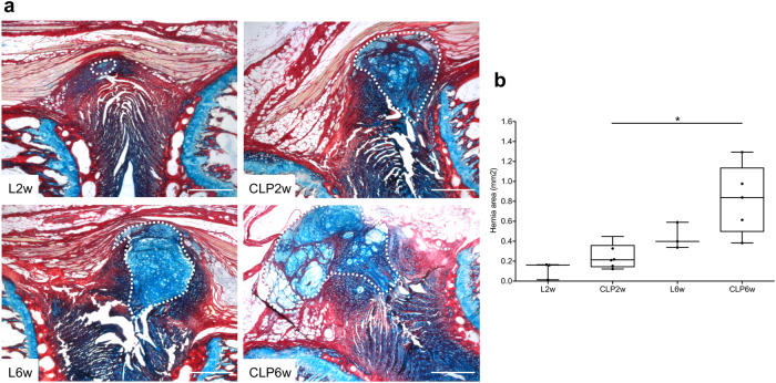 Macrophage-based therapy for intervertebral disc herniation: preclinical proof-of-concept.