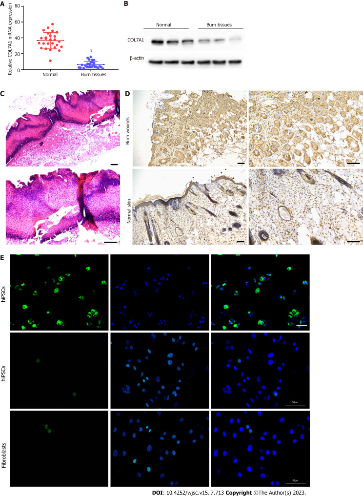 Transplantation of human induced pluripotent stem cell derived keratinocytes accelerates deep second-degree burn wound healing.