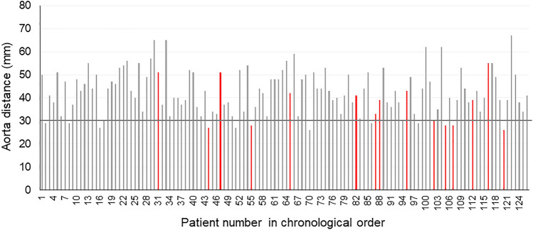 Predictors of the difficulty of transcervical subcarinal lymph node dissection for esophageal cancer.