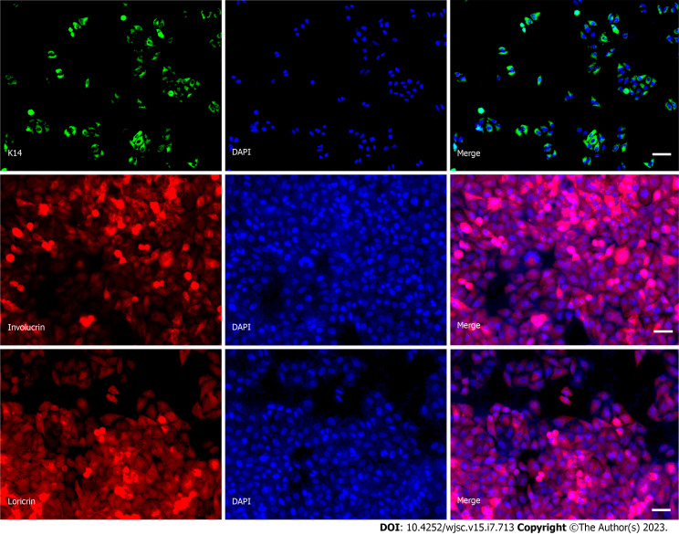 Transplantation of human induced pluripotent stem cell derived keratinocytes accelerates deep second-degree burn wound healing.