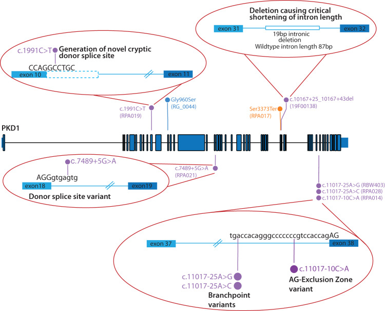 Atypical splicing variants in PKD1 explain most undiagnosed typical familial ADPKD.