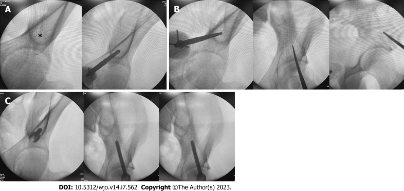 Internal fixator <i>vs</i> external fixator in the management of unstable pelvic ring injuries: A prospective comparative cohort study.