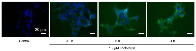 Lactoferrin inhibits the proliferation of IMR‑32 neuroblastoma cells even under X‑rays.