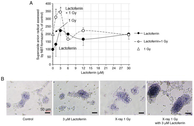 Lactoferrin inhibits the proliferation of IMR‑32 neuroblastoma cells even under X‑rays.