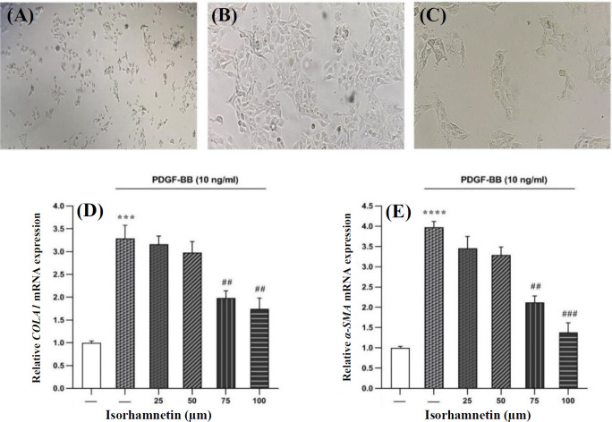 Isorhamnetin Exerts Antifibrotic Effects by Attenuating Platelet-Derived Growth Factor-BB-induced HSC-T6 Cells Activation via Suppressing PI3K-AKT Signaling Pathway