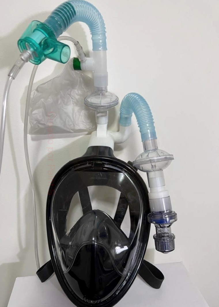 Effect of the modified snorkel mask as noninvasive ventilatory support in patients with acute hypoxemic respiratory failure due to COVID-19.