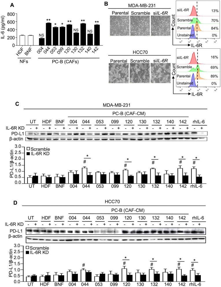 Enhancement of PD-L1-attenuated CAR-T cell function through breast cancer-associated fibroblasts-derived IL-6 signaling via STAT3/AKT pathways.