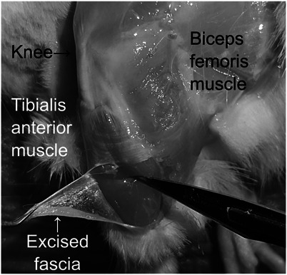 Decreased expression of hyaluronan synthase and loss of hyaluronan-rich cells in the anterior tibial fascia of the rat model of chemotherapy-induced peripheral neuropathy.