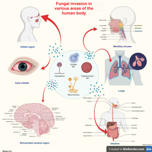 Opportunistic Fungal Invasion in COVID-19 Pandemic: A Critical Review in Diagnosis and Management.