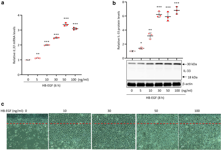 Nuclear IL-33 Plays an Important Role in EGFR-Mediated Keratinocyte Migration by Regulating the Activation of Signal Transducer and Activator of Transcription 3 and NF-κB