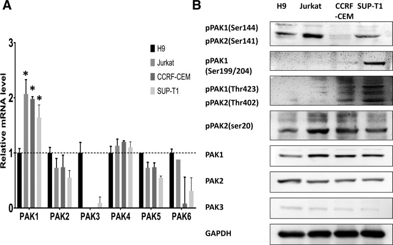 Targeting P21-activated kinase suppresses proliferation and enhances chemosensitivity in T-cell lymphoblastic lymphoma.