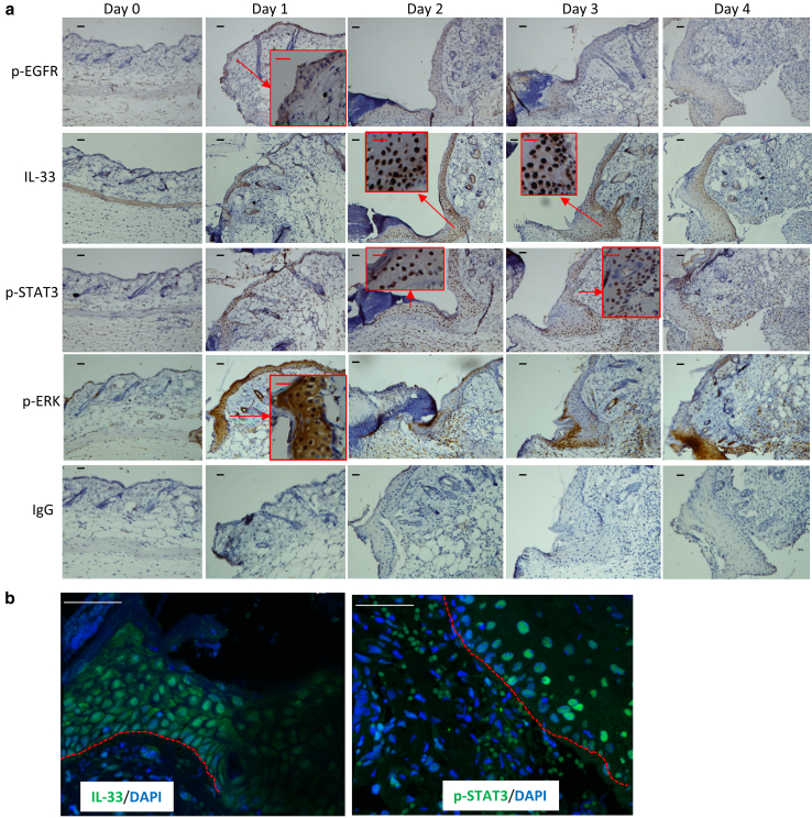 Nuclear IL-33 Plays an Important Role in EGFR-Mediated Keratinocyte Migration by Regulating the Activation of Signal Transducer and Activator of Transcription 3 and NF-κB