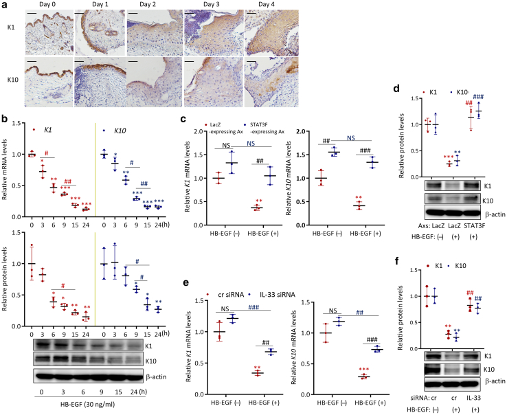 Nuclear IL-33 Plays an Important Role in EGFR-Mediated Keratinocyte Migration by Regulating the Activation of Signal Transducer and Activator of Transcription 3 and NF-κB