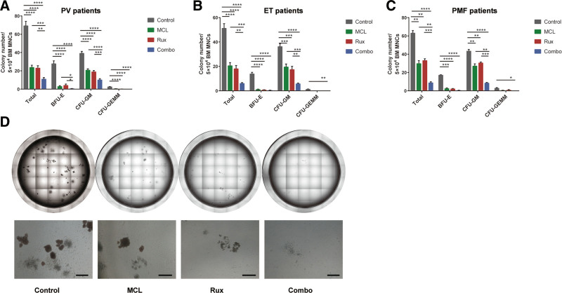 Micheliolide exerts effects in myeloproliferative neoplasms through inhibiting STAT3/5 phosphorylation via covalent binding to STAT3/5 proteins.