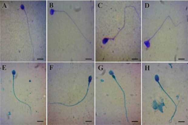 Comparison of Diff-Quick and Spermac Staining Methods for Sperm Morphology Evaluation.