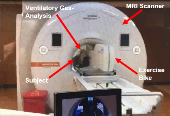 Simultaneous exercise stress cardiac magnetic resonance and cardiopulmonary exercise testing to elucidate the Fick components of aerobic exercise capacity: a feasibility and reproducibility study and pilot study in hematologic cancer survivors.