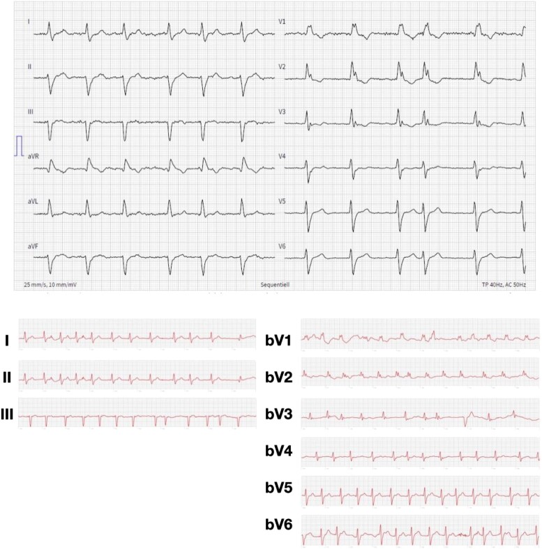 An augmented reality-based method to assess precordial electrocardiogram leads: a feasibility trial.