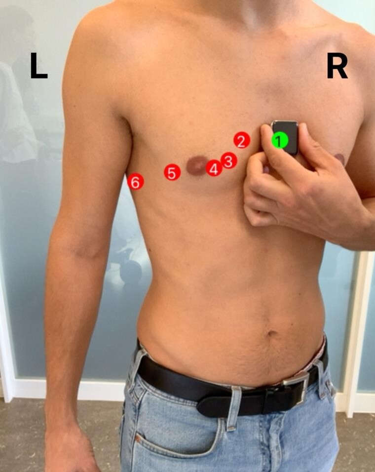 An augmented reality-based method to assess precordial electrocardiogram leads: a feasibility trial.