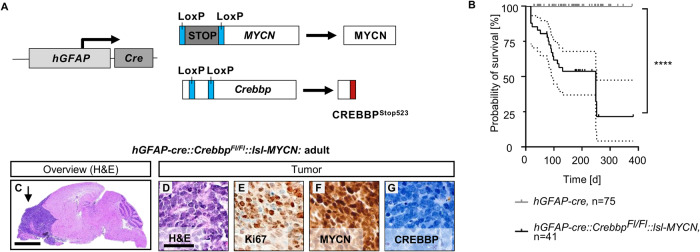 The tumor suppressor CREBBP and the oncogene MYCN cooperate to induce malignant brain tumors in mice.