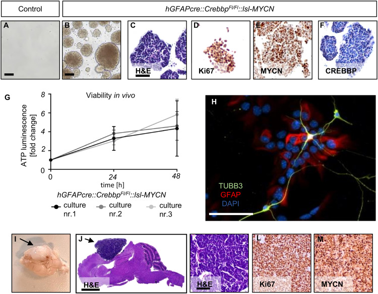 The tumor suppressor CREBBP and the oncogene MYCN cooperate to induce malignant brain tumors in mice.