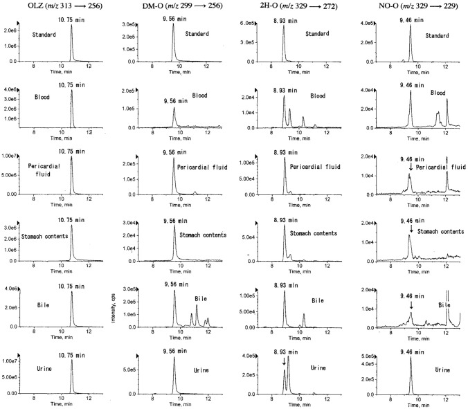 Quantification of olanzapine and its three metabolites by liquid chromatography-tandem mass spectrometry in human body fluids obtained from four deceased, and confirmation of the reduction from olanzapine N-oxide to olanzapine in whole blood in vitro.