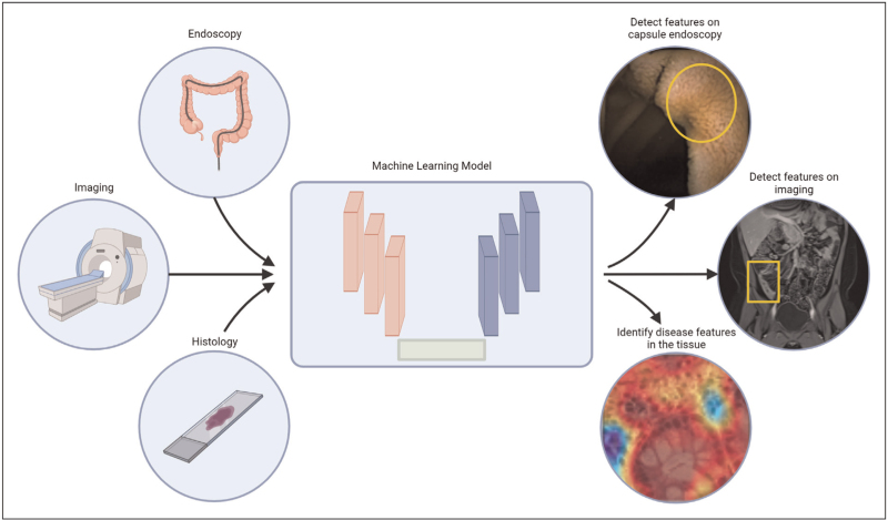 Machine and deep learning in inflammatory bowel disease.