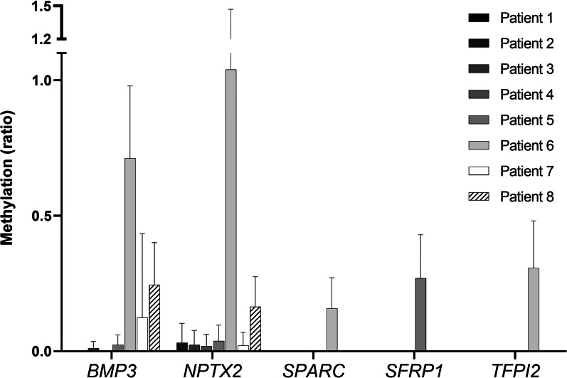 Circulating NPTX2 methylation as a non-invasive biomarker for prognosis and monitoring of metastatic pancreatic cancer.