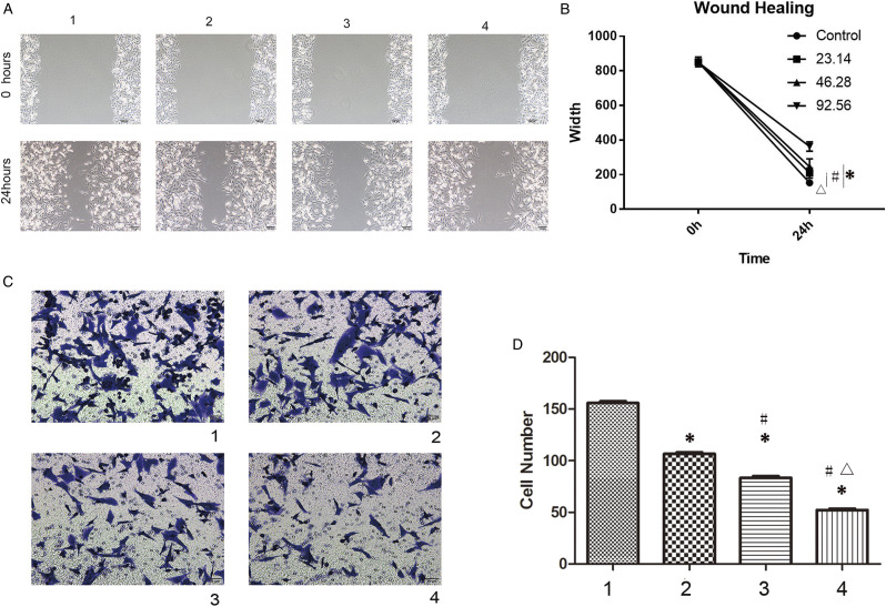 Scutellarin Inhibits Glioblastoma Growth in a Dose-dependent Manner by Suppressing the p63 Signaling Pathway.