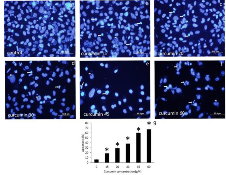 Cytotoxicity of curcumin against CD44<sup>±</sup> prostate cancer cells: Roles of miR-383 and miR-708.