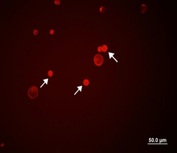 Cytotoxicity of curcumin against CD44<sup>±</sup> prostate cancer cells: Roles of miR-383 and miR-708.