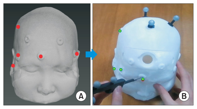 Simulation Method for the Physical Deformation of a Three-Dimensional Soft Body in Augmented Reality-Based External Ventricular Drainage.